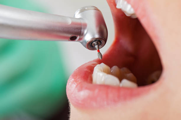 Best Urgent Tooth Repair  in Sayre, PA